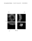 ENHANCED IMAGING FOR OPTICAL COHERENCE TOMOGRAPHY diagram and image
