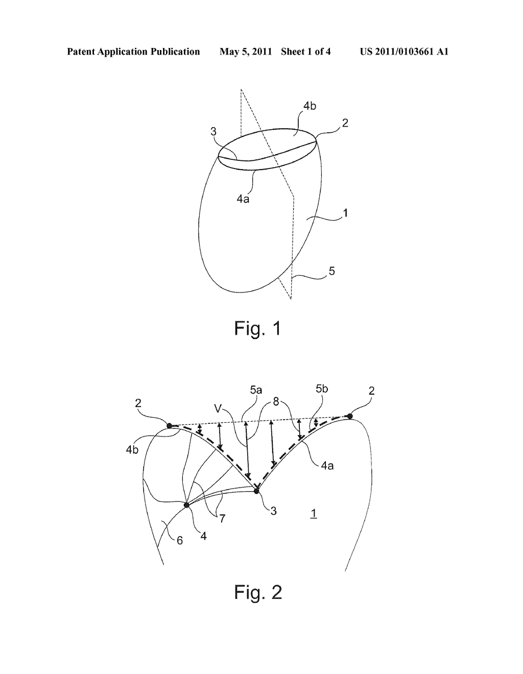 METHOD AND DEVICE FOR SEGMENTING MEDICAL IMAGE DATA - diagram, schematic, and image 02