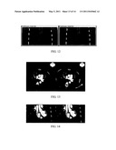 METHOD FOR CIRCULAR SCAN RECONSTRUCTION IN COMPUTED TOMOGRAPHY AND COMPUTED TOMOGRAPHIC DEVICE diagram and image