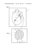 METHOD FOR HIGHLIGHTING LOCAL CHARACTERISTICS IN ANATOMICAL VOLUME RENDERINGS OF VESSEL STRUCTURES AND COMPUTER SYSTEM FOR CARRYING OUT THIS METHOD diagram and image