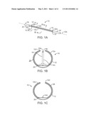 TREATMENT OF RENAL HYPERTENSION OR CAROTID SINUS SYNDROME WITH ADVENTITIAL PHARMACEUTICAL SYMPATHETIC DENERVATION OR NEUROMODULATION diagram and image