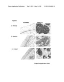 Biomarkers for Head-And-Neck Cancers and Precancers diagram and image