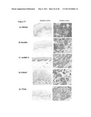 Biomarkers for Head-And-Neck Cancers and Precancers diagram and image