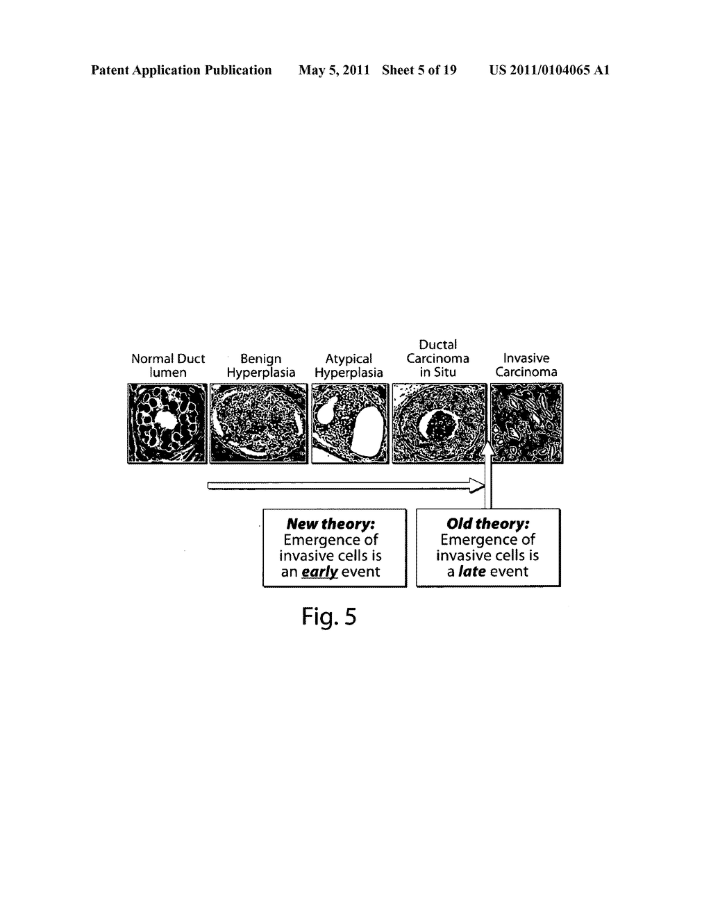 GENETIC ALTERATION ASSOCIATED WITH PRE-MALIGNANT CANCER - diagram, schematic, and image 06