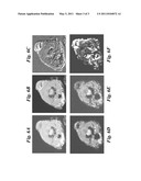 TREATING WATER INSOLUBLE NANOPARTICLES WITH HYDROPHILIC ALPHA-HYDROXYPHOSPHONIC ACID CONJUGATES, THE SO MODIFIED NANOPARTICLES AND THEIR USE AS CONTRAST AGENTS diagram and image