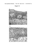 INHIBITION OF DEGRADATION OF EXTRACELLULAR MATRIX diagram and image