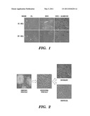 COMPOSITIONS OF NOVEL BONE PATCH IN BONE AND VASCULAR REGENERATION diagram and image