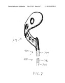 Single-Arm Golf Club diagram and image