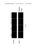 COMPOSITIONS AND METHODS FOR TREATING CORNEAL INFLAMMATION diagram and image