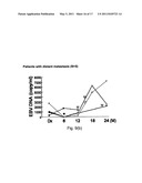 Method of Detecting Malignancy of Nasopharyngeal Carcinoma and A Nasopharyngeal Carcinoma Malignancy Biomarker diagram and image