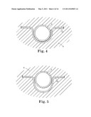 TRANSOBTURATOR METHODS FOR INSTALLING SLING TO TREAT INCONTINENCE, AND RELATED DEVICES diagram and image