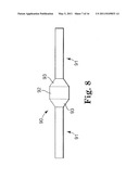 TRANSOBTURATOR METHODS FOR INSTALLING SLING TO TREAT INCONTINENCE, AND RELATED DEVICES diagram and image