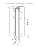 TRANSOBTURATOR METHODS FOR INSTALLING SLING TO TREAT INCONTINENCE, AND RELATED DEVICES diagram and image