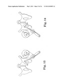 TRANSOBTURATOR METHODS FOR INSTALLING SLING TO TREAT INCONTINENCE, AND RELATED DEVICES diagram and image