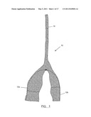 System and Method for Treating Prolapse and Incontinence diagram and image