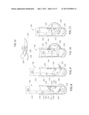 System and Method for Treating Prolapse and Incontinence diagram and image