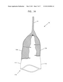 System and Method for Treating Prolapse and Incontinence diagram and image