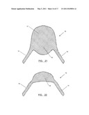 System and Method for Treating Prolapse and Incontinence diagram and image