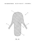 System and Method for Treating Prolapse and Incontinence diagram and image