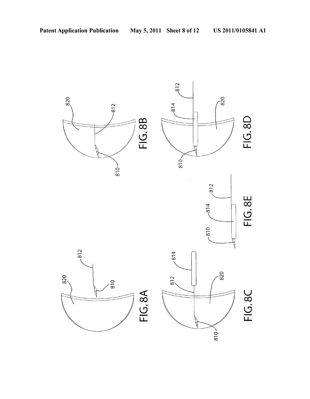 MEDICAL INSTRUMENT SYSTEM AND METHOD FOR MANIPULATING TARGET TISSUE - diagram, schematic, and image 09