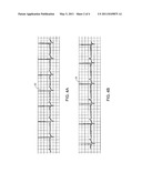 BIOMEDICAL SENSING METHODS EMPLOYING HYDRO-INSENSITIVE ALTERNATING CURRENT RESPONSIVE COMPOSITES diagram and image