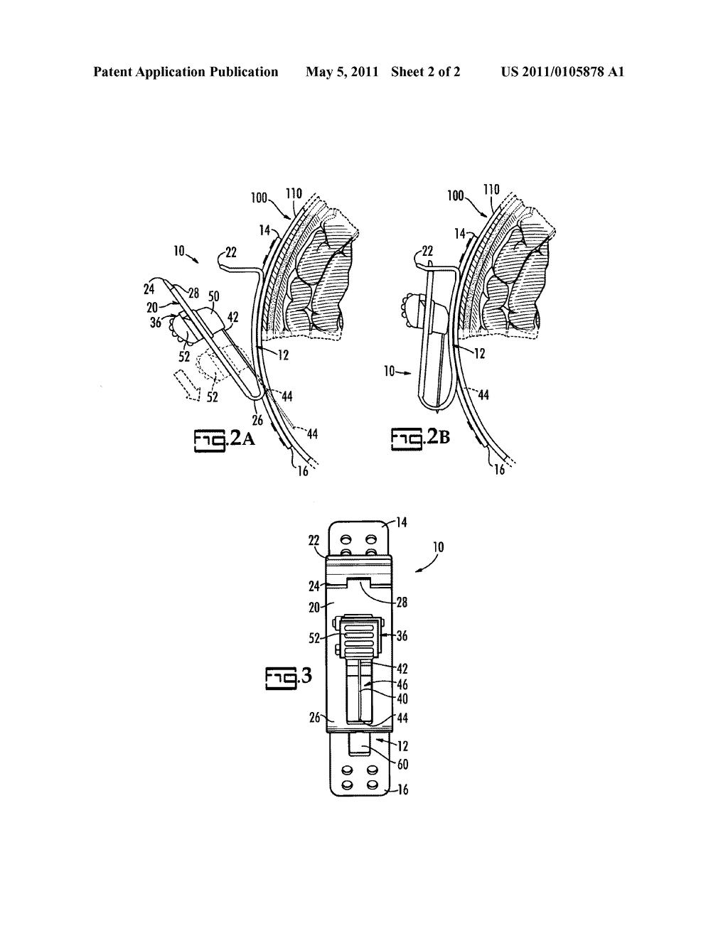 Electrode For Use With A Template Cap - diagram, schematic, and image 03