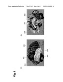 BRAIN DISEASE DIAGNOSIS SYSTEM diagram and image