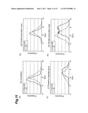 BRAIN DISEASE DIAGNOSIS SYSTEM diagram and image