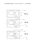 Methods of Predicting Musculoskeletal Disease diagram and image