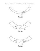 Methods of Predicting Musculoskeletal Disease diagram and image