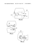 Methods of Predicting Musculoskeletal Disease diagram and image