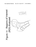 Methods of Predicting Musculoskeletal Disease diagram and image