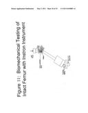 Methods of Predicting Musculoskeletal Disease diagram and image