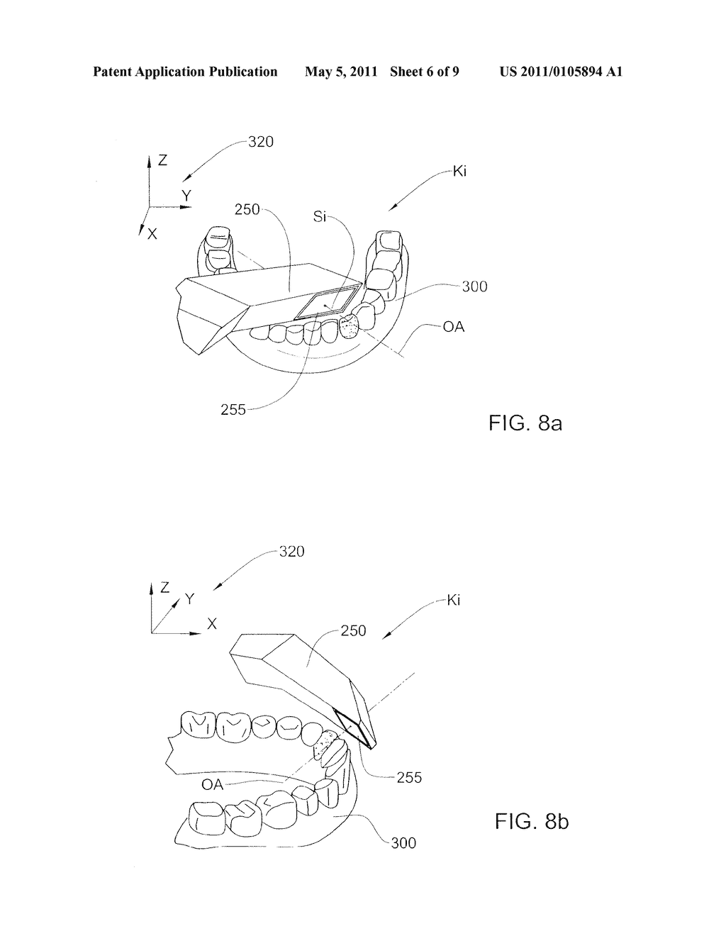 SYSTEM AND METHOD FOR SCANNING AN INTRAORAL CAVITY - diagram, schematic, and image 07