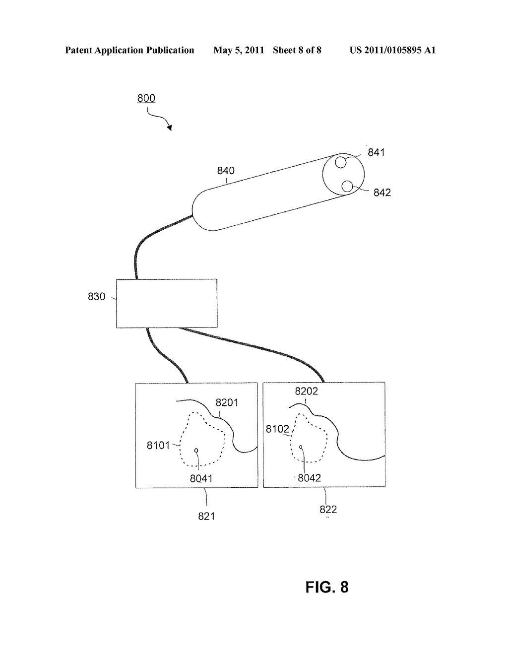 GUIDED SURGERY - diagram, schematic, and image 09