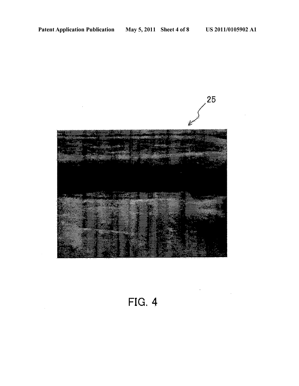 PROCESSING DEVICE FOR ULTRASONIC TOMOGRAPHIC IMAGE - diagram, schematic, and image 05