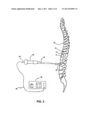 ULTRASONIC DEVICES AND METHODS TO DIAGNOSE PAIN GENERATORS diagram and image