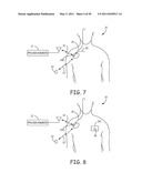 Method for Monitoring or Treating Nervous System Disorders diagram and image