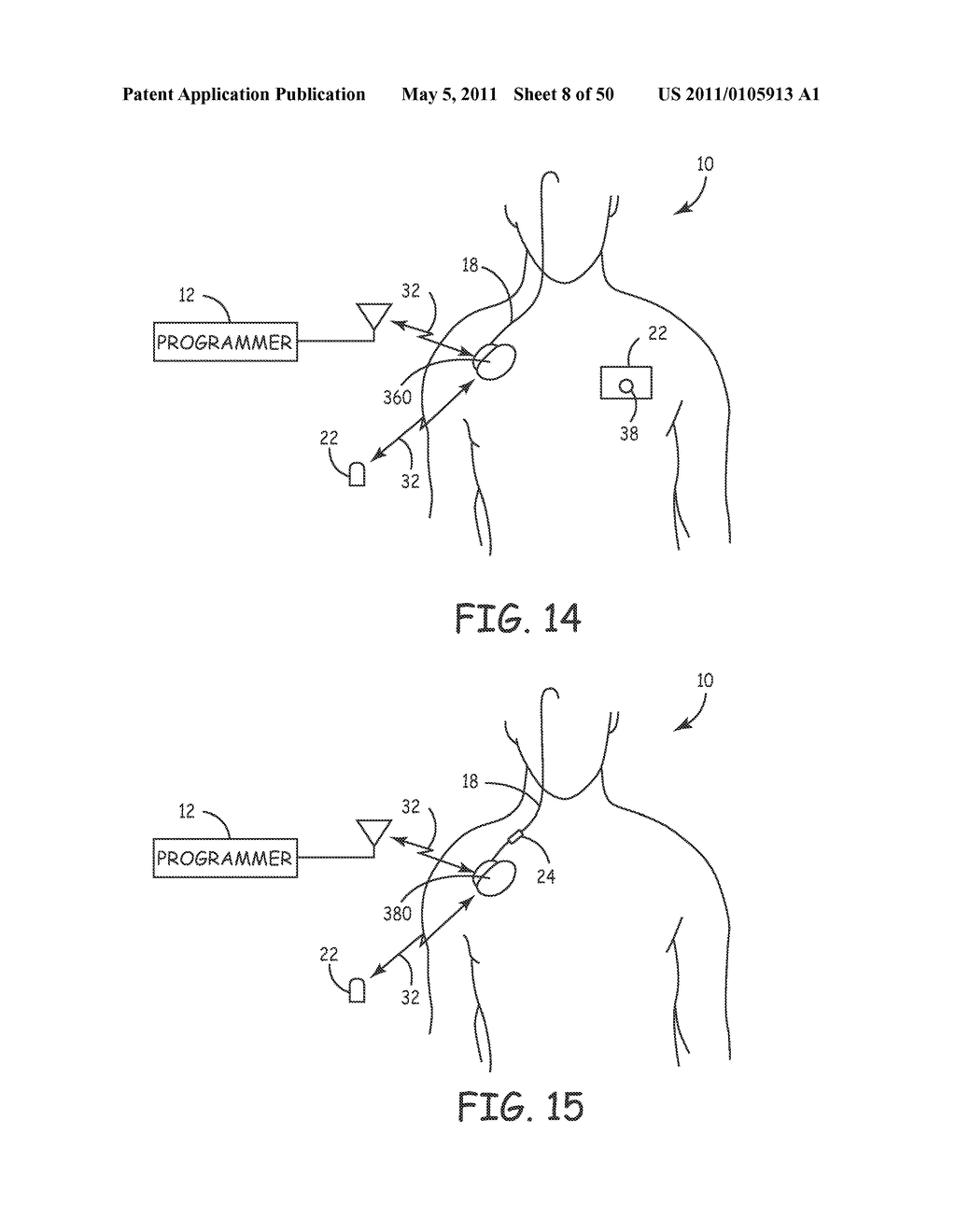 Method for Monitoring or Treating Nervous System Disorders - diagram, schematic, and image 09