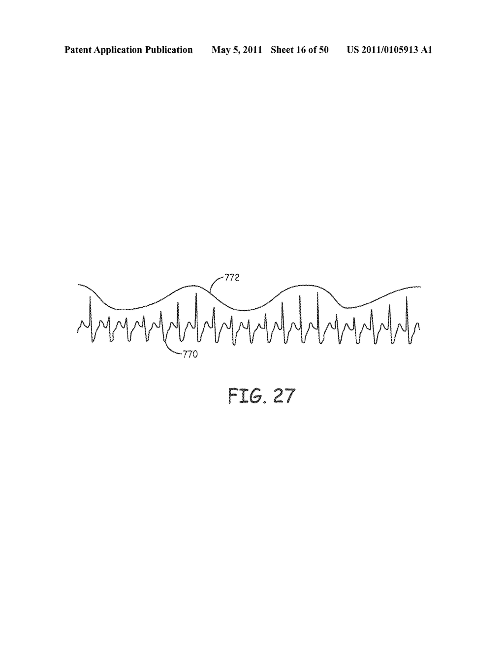 Method for Monitoring or Treating Nervous System Disorders - diagram, schematic, and image 17