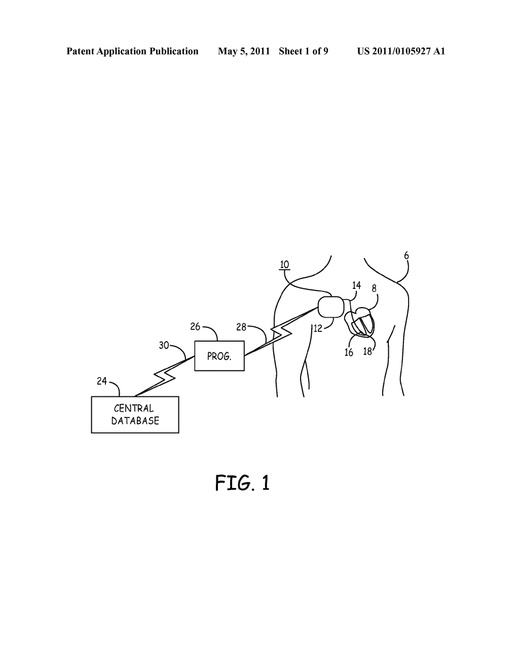 DETECTION OF WAVEFORM ARTIFACT - diagram, schematic, and image 02