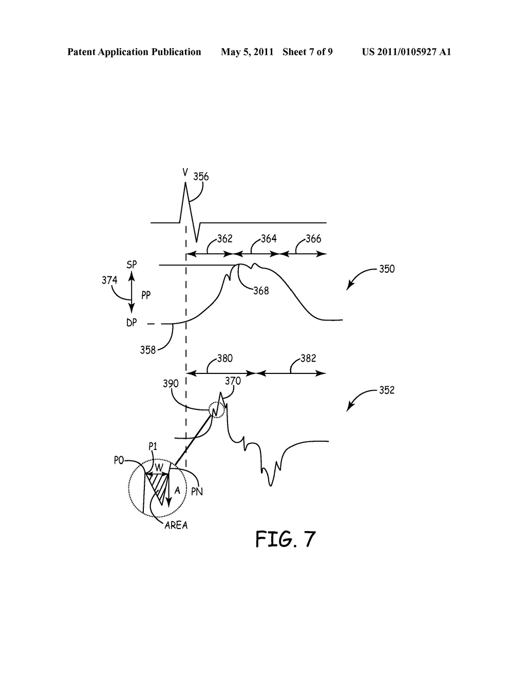 DETECTION OF WAVEFORM ARTIFACT - diagram, schematic, and image 08