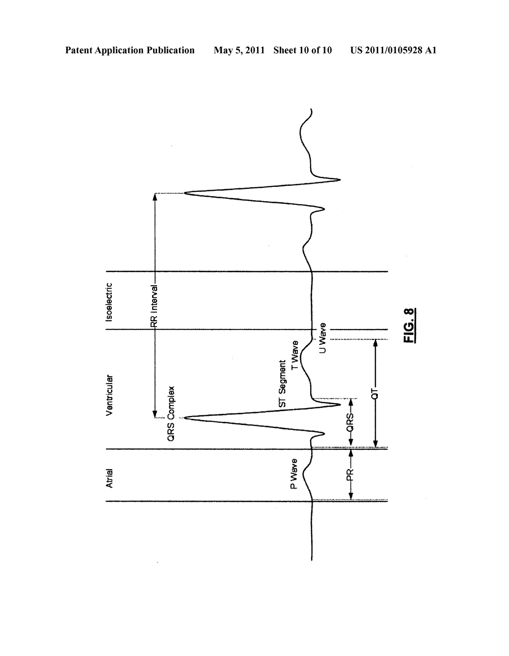 ECG Reconstruction For Atrial Activity Monitoring And Detection - diagram, schematic, and image 11