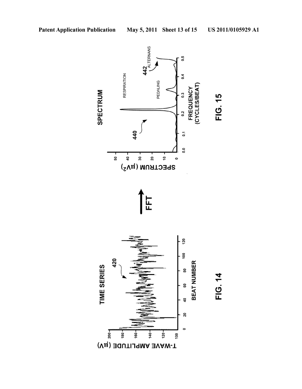 MEASURING T-WAVE ALTERNANS - diagram, schematic, and image 14