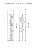 TRUE ECG MEASUREMENT DURING CARDIO PULMONARY RESUSCITATION BY ADAPTIVE PIECEWISE STITCHING ALGORITHM diagram and image