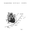 MULTI-AXIAL HEART SOUNDS AND MURMUR DETECTION FOR HEMODYNAMIC-CONDITION ASSESSMENT diagram and image