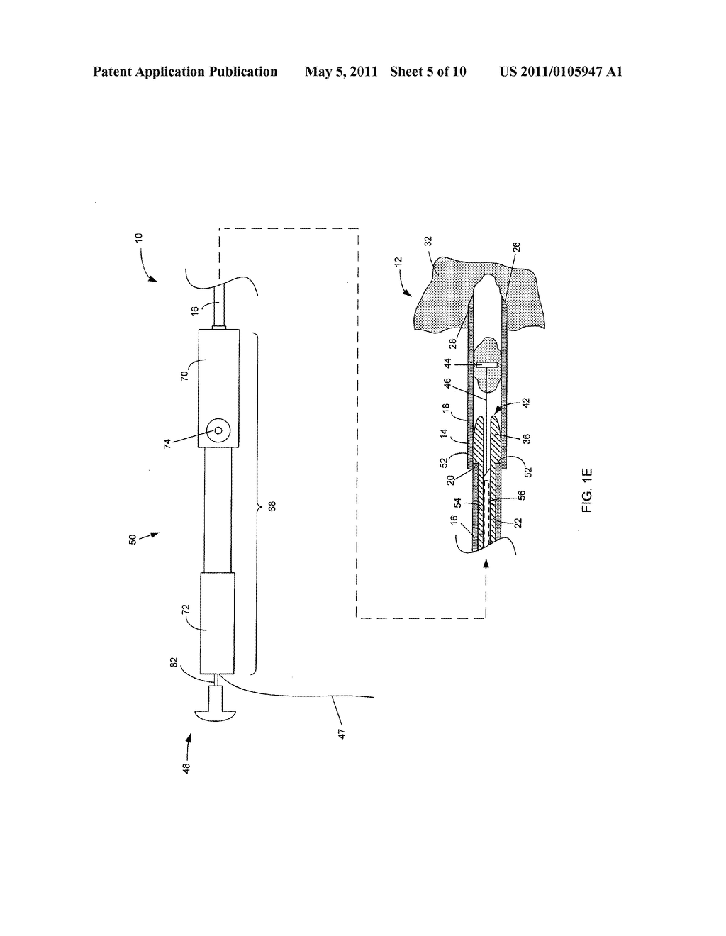 SYSTEM AND METHOD FOR PERFORMING A FULL THICKNESS TISSUE BIOPSY - diagram, schematic, and image 06