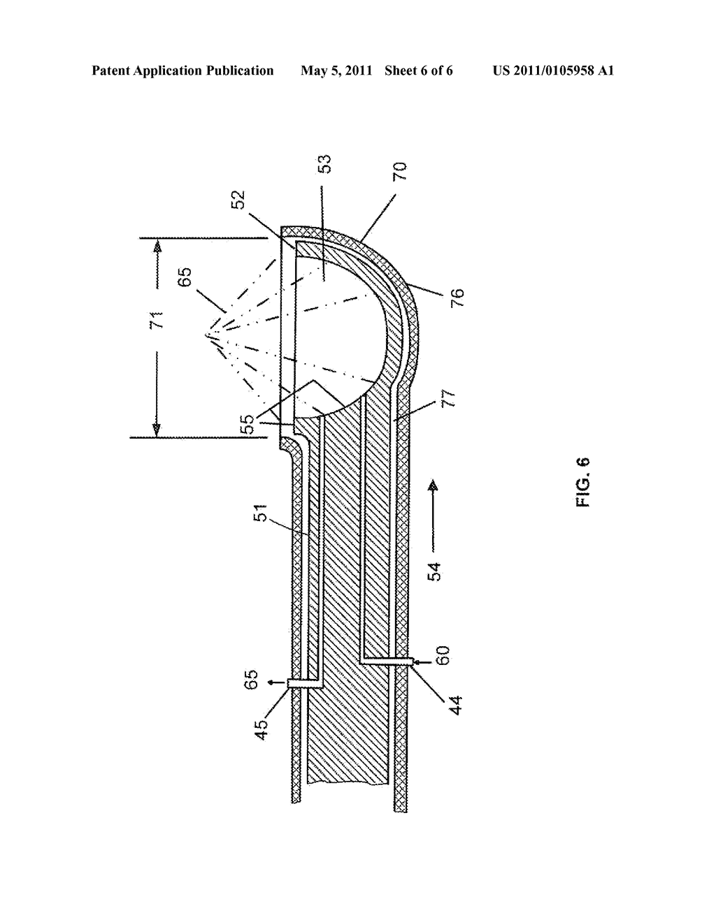 ULTRASOUND APPARATUS AND METHODS FOR MITIGATION OF NEUROLOGICAL DAMAGE - diagram, schematic, and image 07