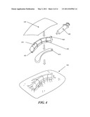 CLOSED INCISION NEGATIVE PRESSURE WOUND THERAPY DEVICE AND METHODS OF USE diagram and image