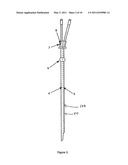 DUAL LUMEN DIALYSIS CATHETER WITH INTERNALLY BORED OR EXTERNALLY-GROOVED SMALL BORE diagram and image